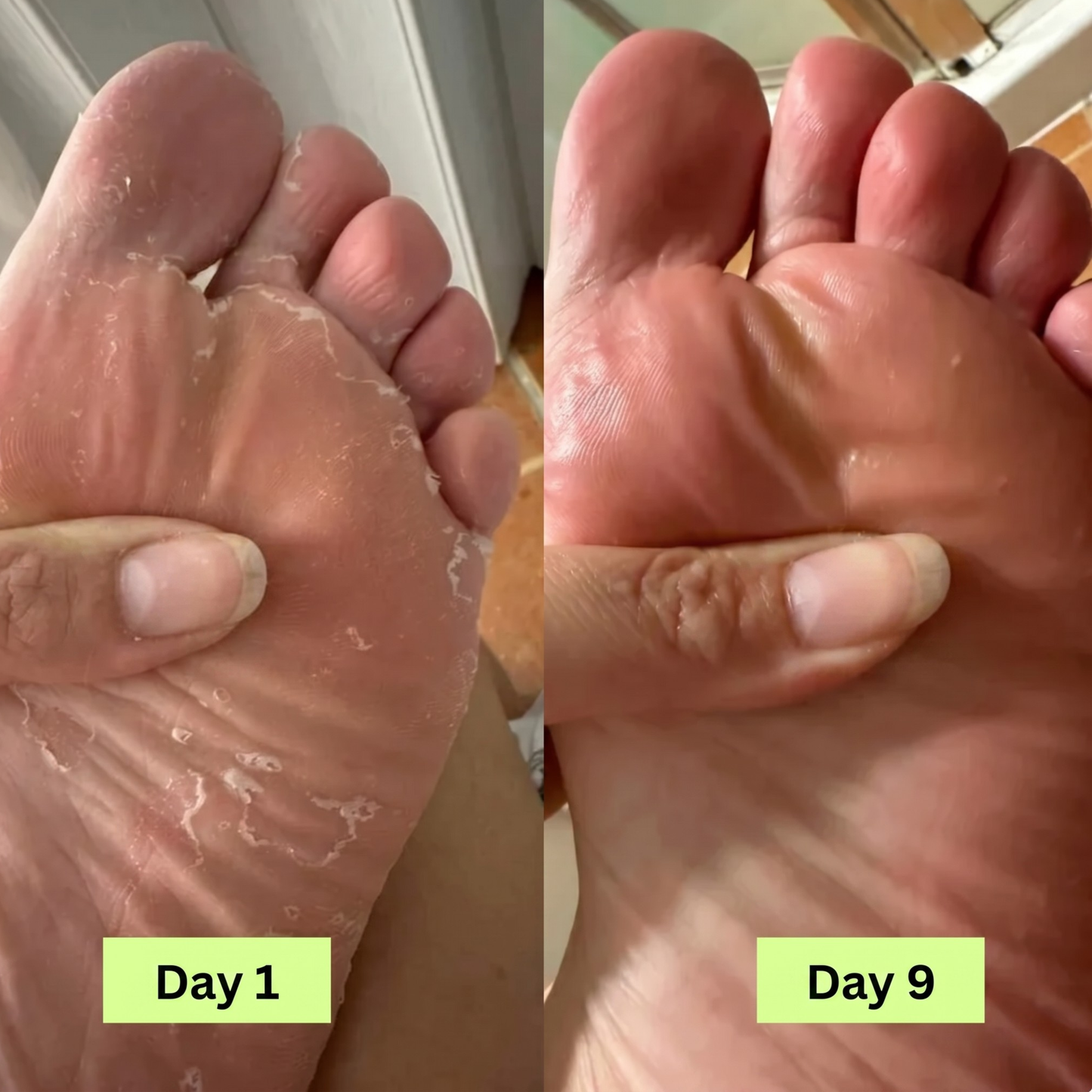 Purifying Antifungal Soap