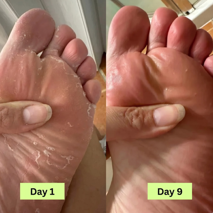 Purifying Antifungal Soap