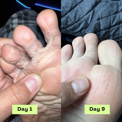 Purifying Antifungal Soap